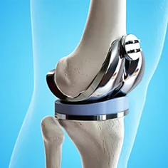 ارتوپدی و تروماتولوژی